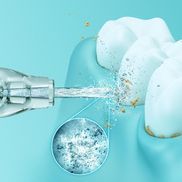 Ultraschalltechnologie für eine optimierte Zahnpflege